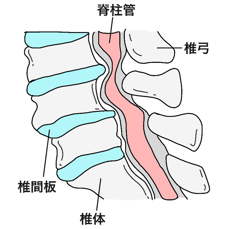 脊柱管狭窄症のイメージ画像